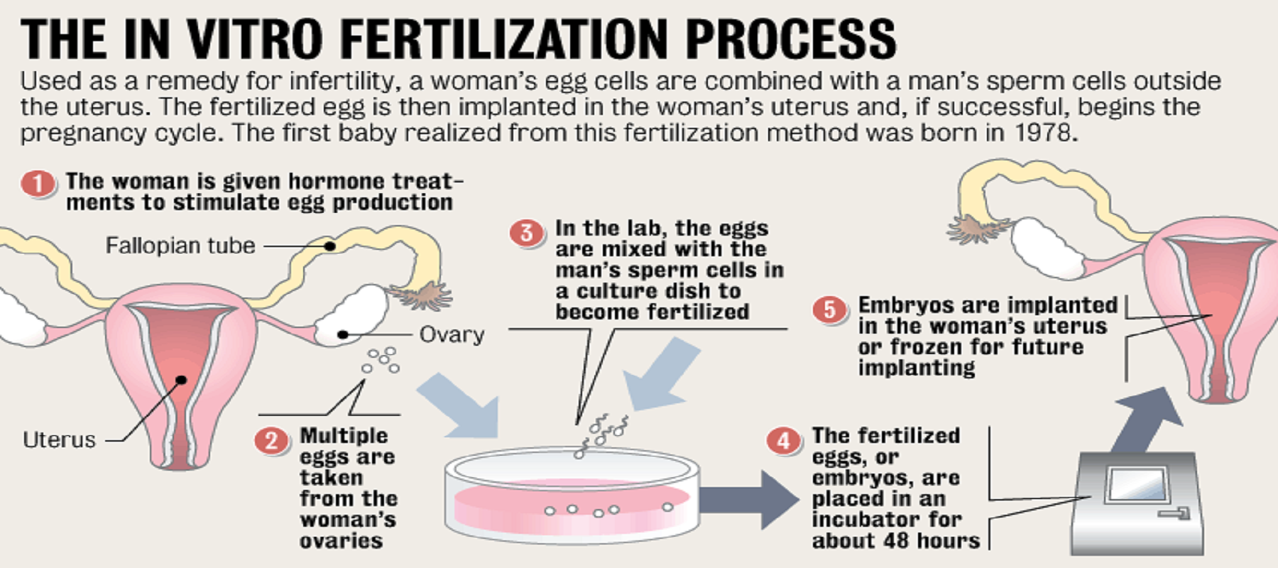 how to get ivf