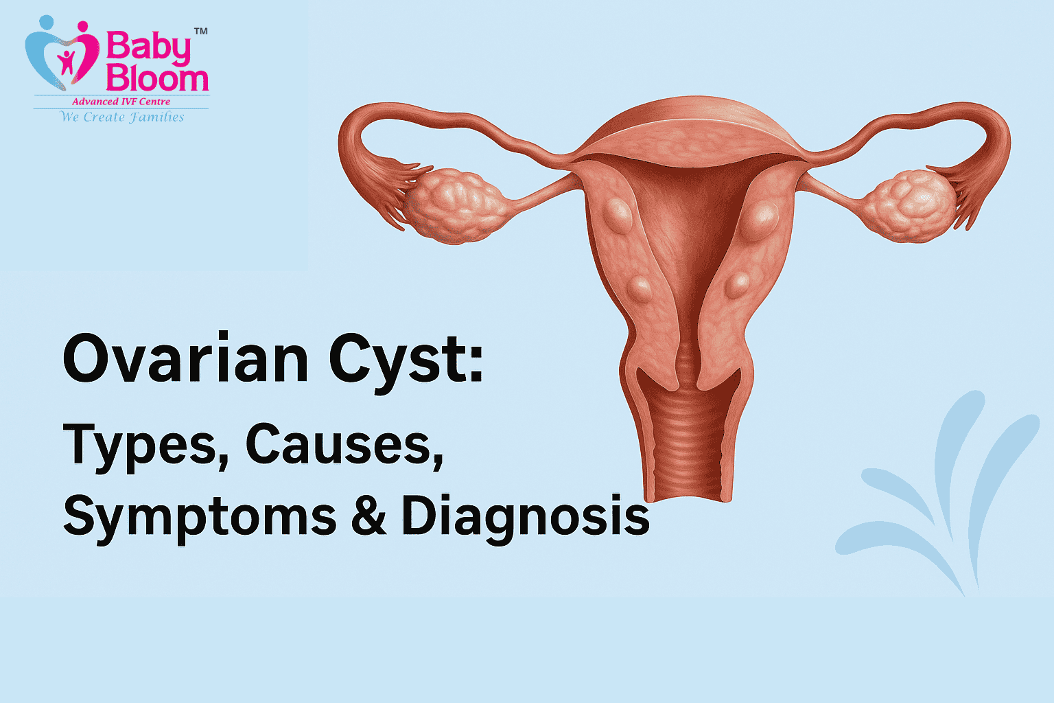 What Is a Hemorrhagic Ovarian Cyst? Signs, Causes & How to Recover