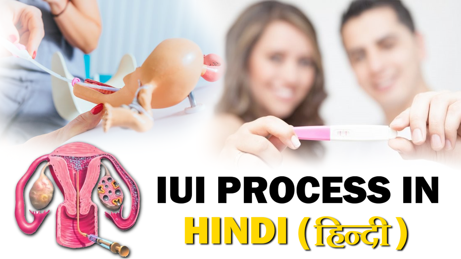 IUI Process in Hindi: एक संपूर्ण मार्गदर्शिका