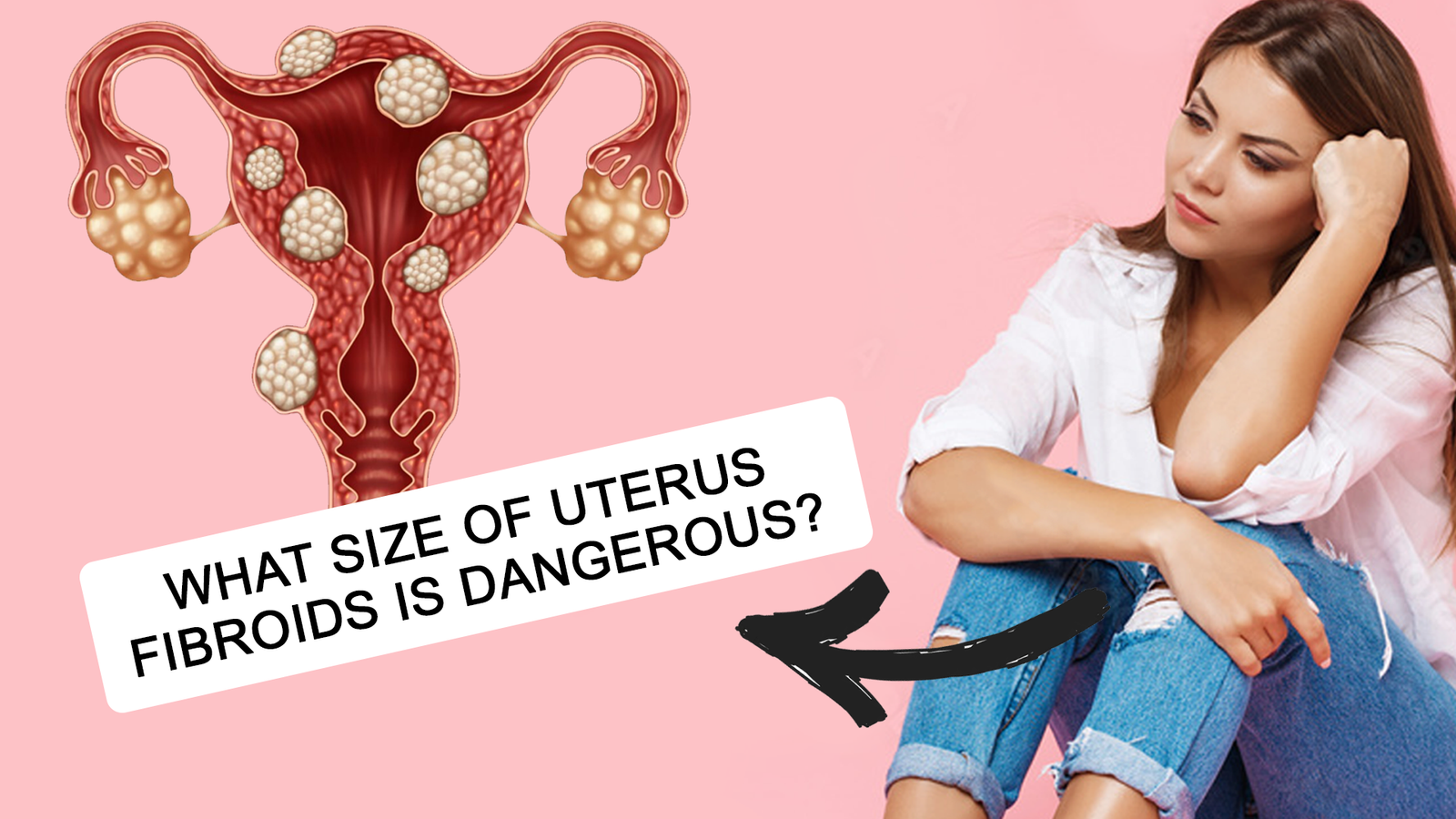 Dangerous Fibroid Size || Large Uterine Fibroids || Fibroid Symptoms