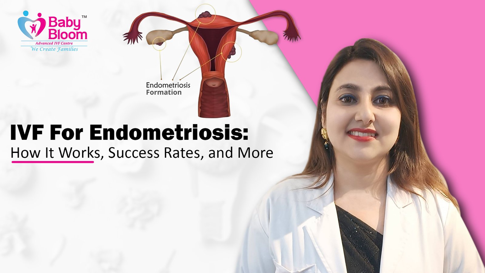 Considerations and Potential Complications Related to IVF For Endometriosis