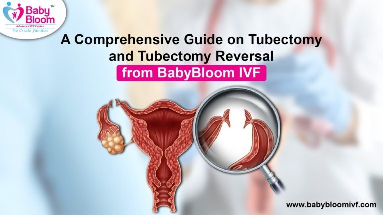 Tubectomy Meaning and guide about tubectomy, image will describe tubectomy