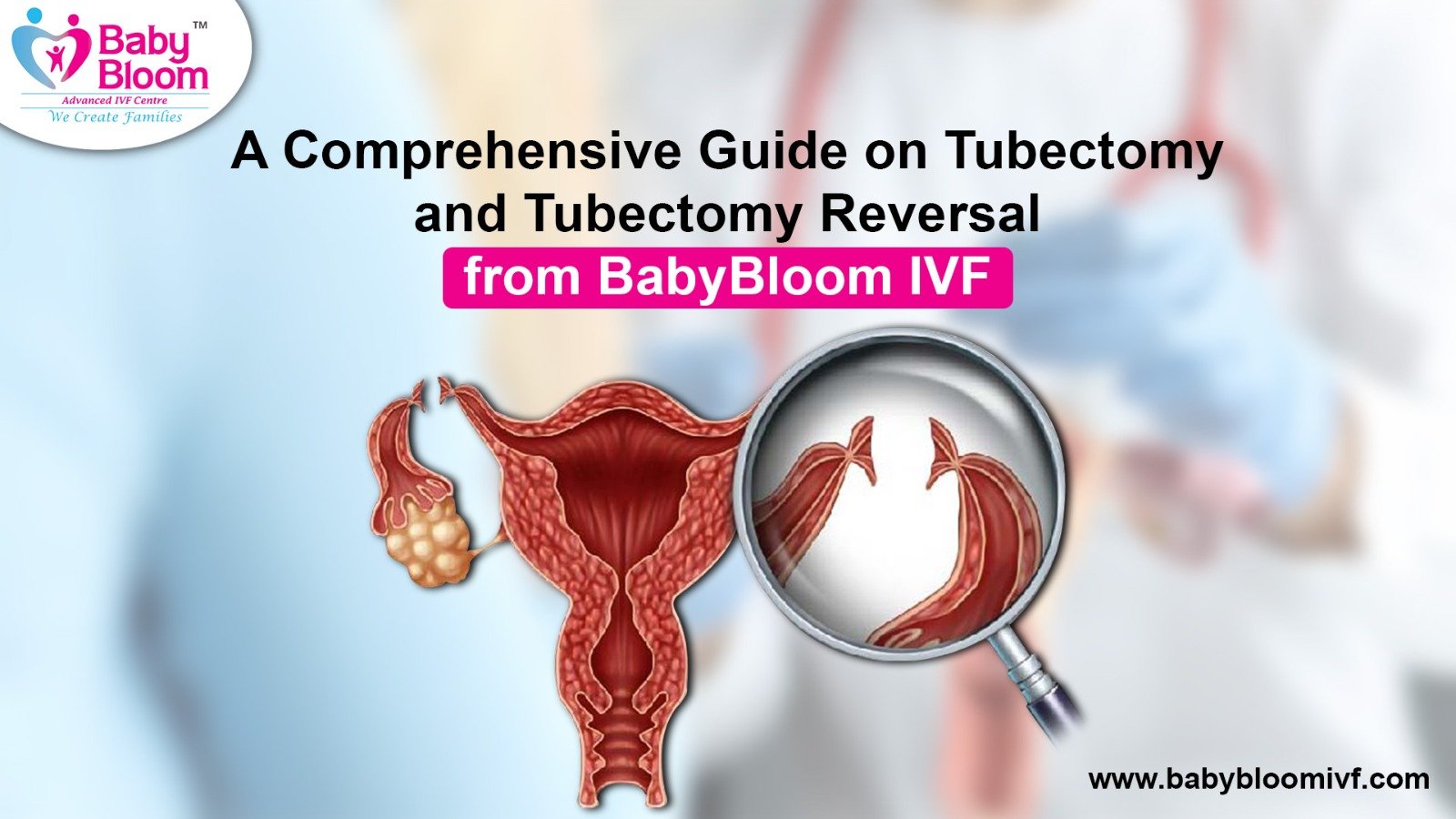 Tubectomy: Indications, Techniques, and Recovery