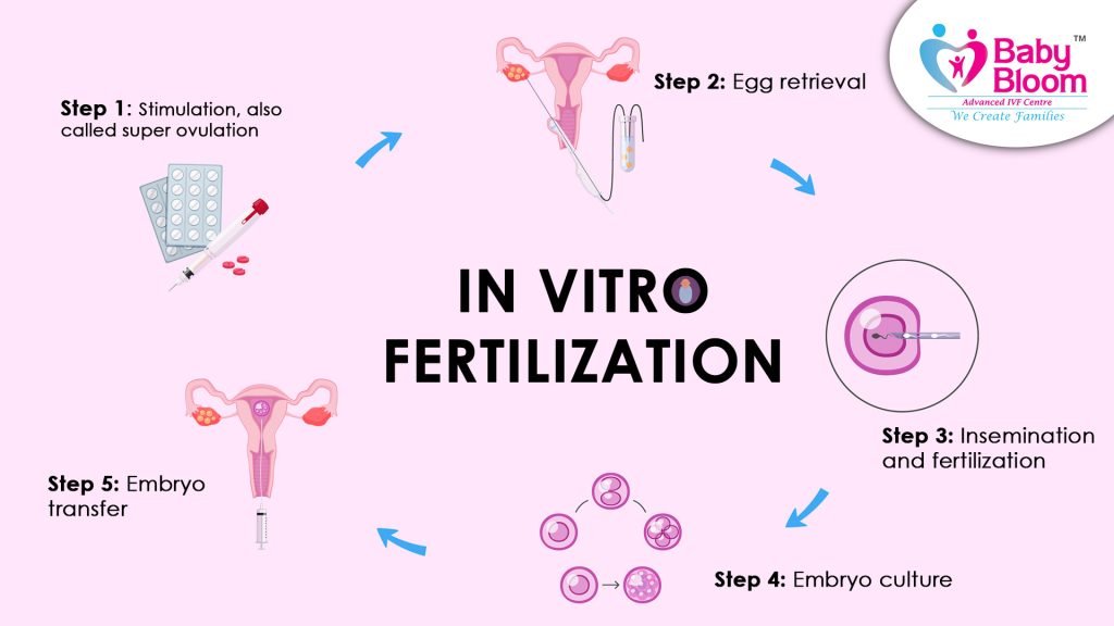 Understanding the IVF Process, 5 step process shown in this image to show IVF process