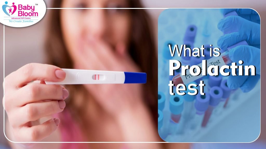 What is prolactin test? a image is describe in this picture is prolactin test process, a woman test his prolactin through kit