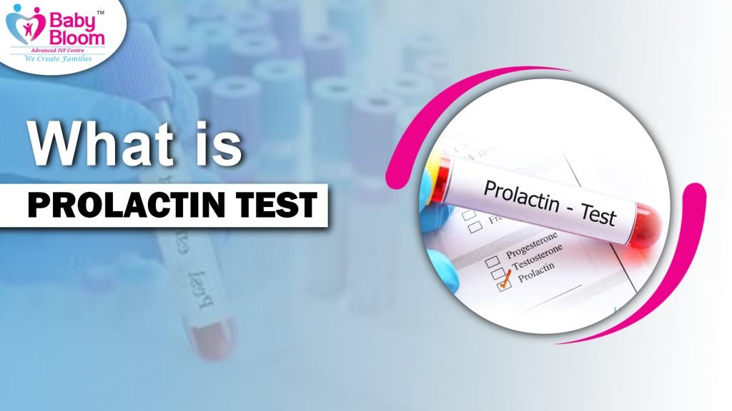 What is prolactin test? a image is describe in this picture is prolactin test process