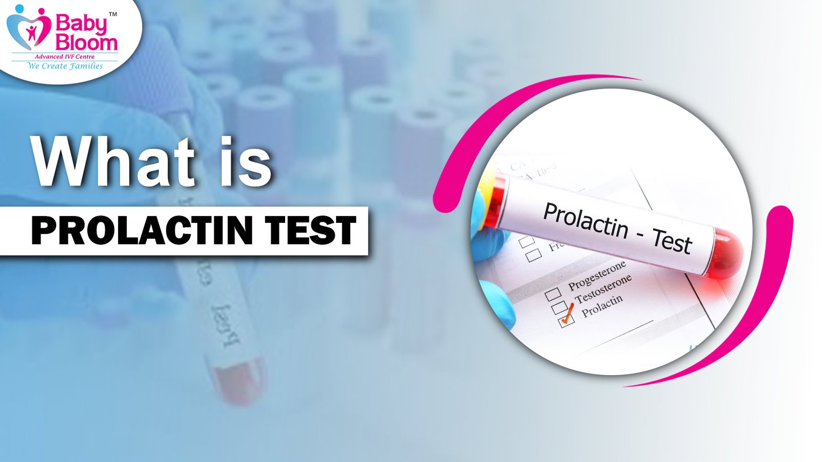 Prolactin Test in Hindi: प्रोलैक्टिन लेवल की जांच का महत्व और प्रक्रिया