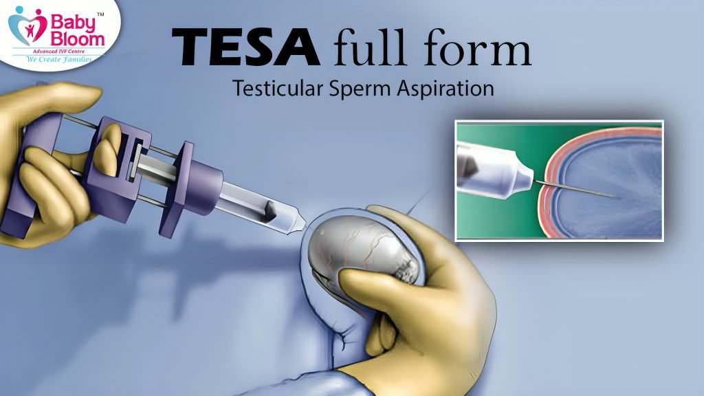 TESA full form testicular sperm aspiration, image showing process of tesa in this picture