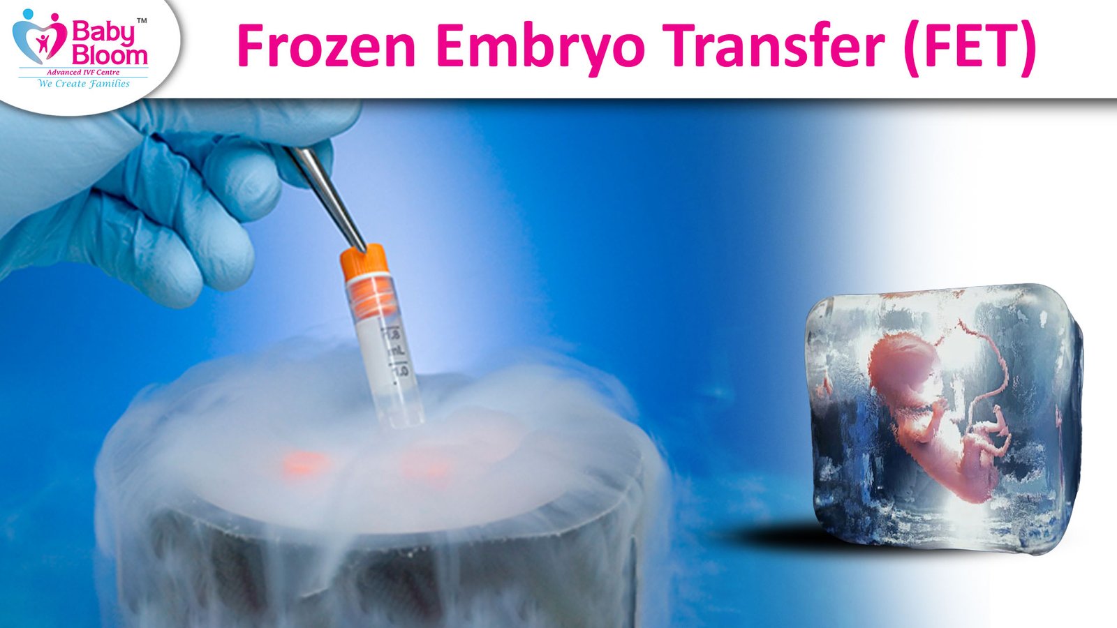 Frozen Embryo Transfer, (FET) 