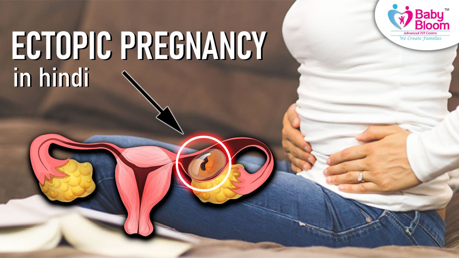  Ectopic Pregnancy in Hindi, Pregnancy, babybloom ivf