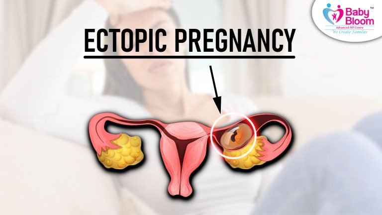 Ectopic Pregnancy in Hindi: लक्षण, कारण और बचाव के उपाय