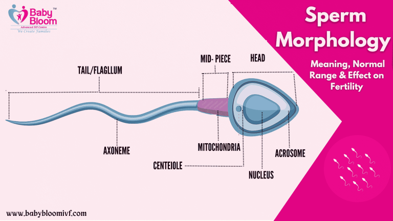 “Sperm Morphology Explained – Structure, Parts, and Role in Fertility | Baby Bloom IVF”