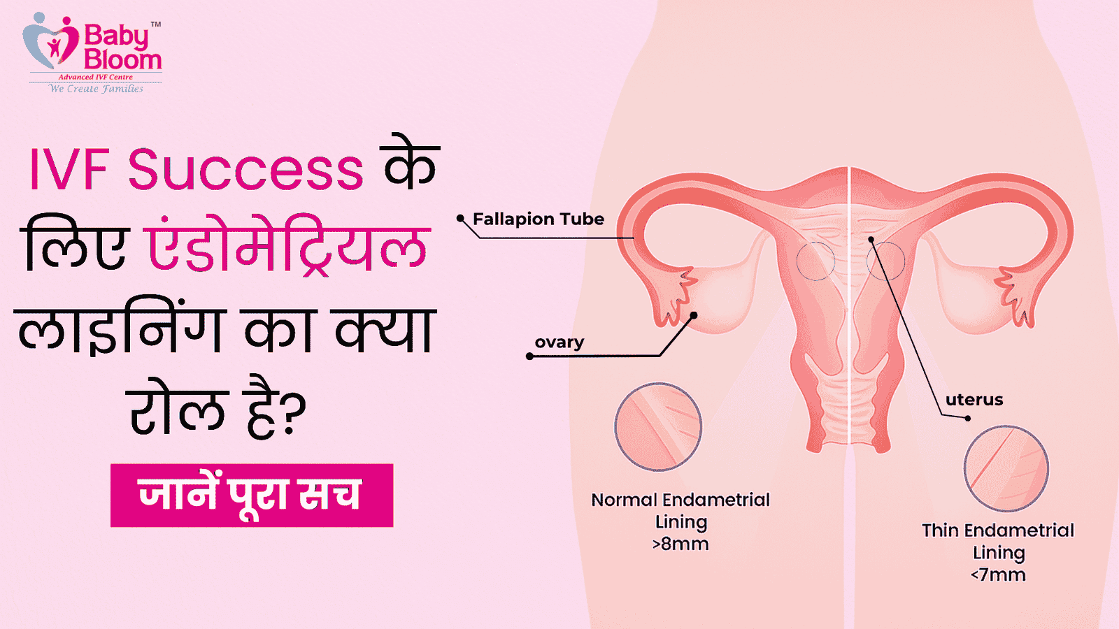 IVF Success के लिए Endometrial Lining का क्या रोल है? जानें पूरा सच