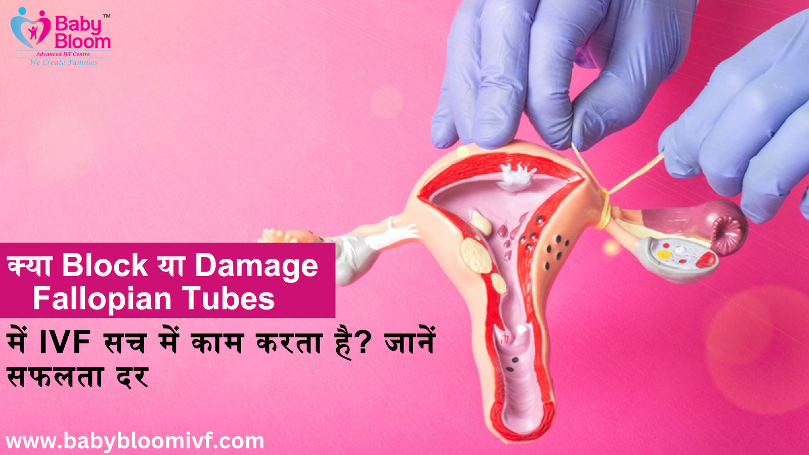 क्या Block या Damage Fallopian Tubes में IVF सच में काम करता है? जानें सफलता दर
