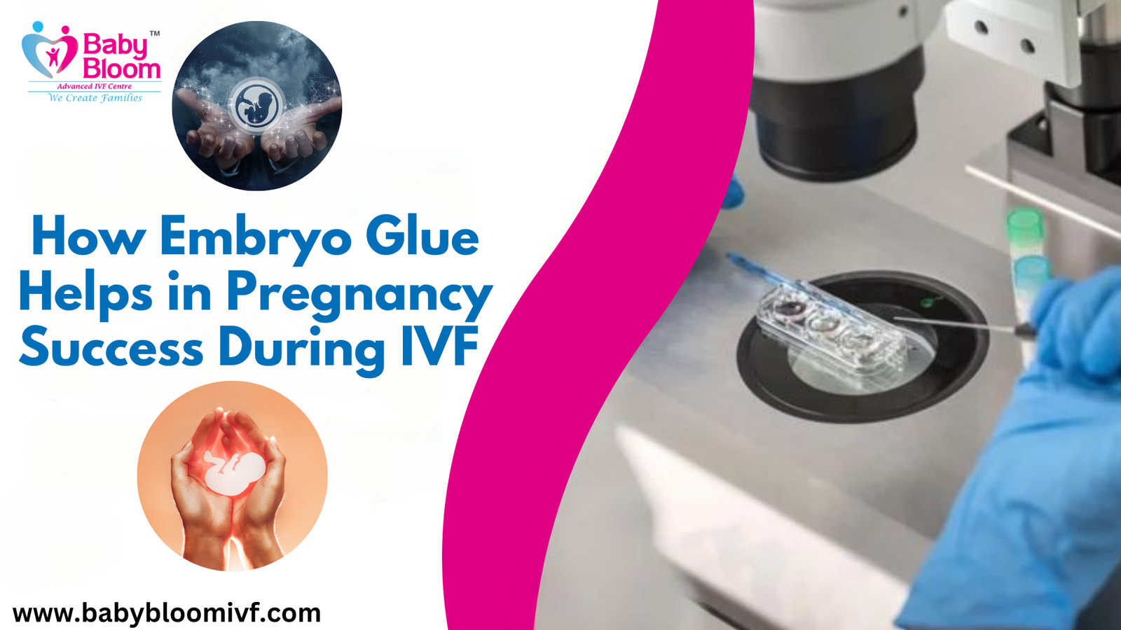 Embryo Glue IVF में embryo को uterus lining से चिपकने में मदद करता है, जिससे implantation के chances बढ़ते हैं और pregnancy success rate improve होता है।