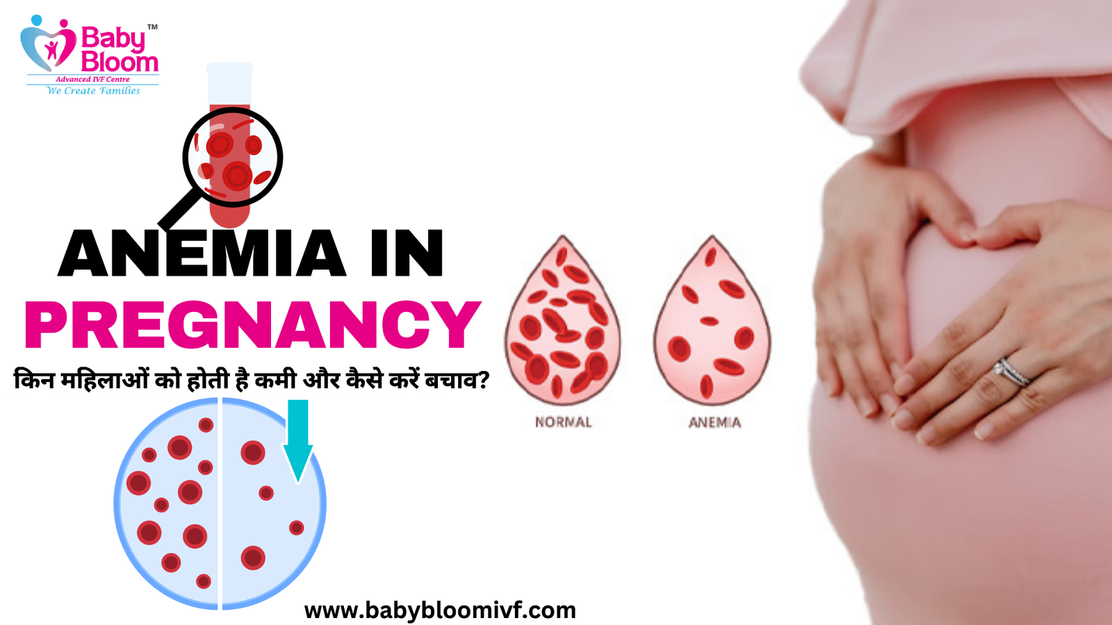Anemia in Pregnancy: किन महिलाओं को होती है कमी और कैसे करें बचाव?