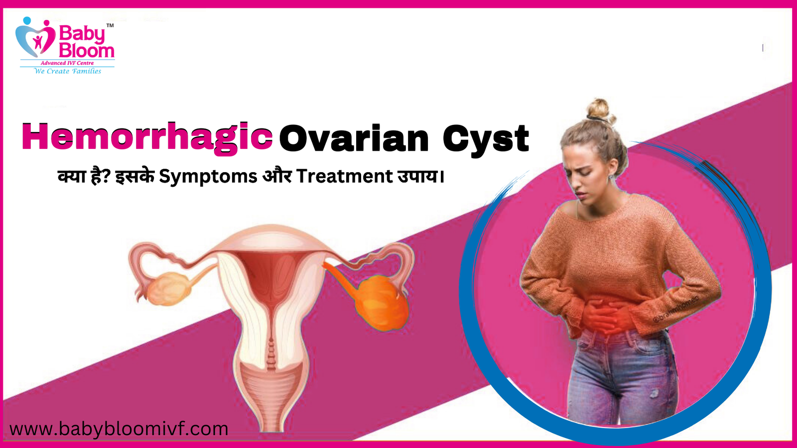 Hemorrhagic Ovarian Cyst क्या है? Symptoms और Treatment