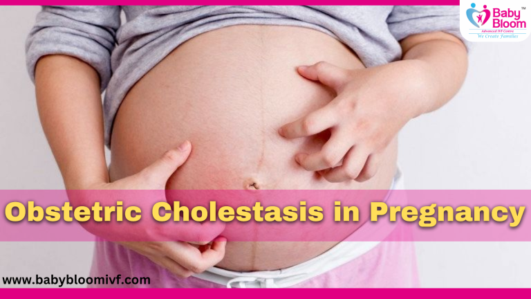 लक्षण, कारण और उपचार Obstetric Cholestasis in Pregnancy