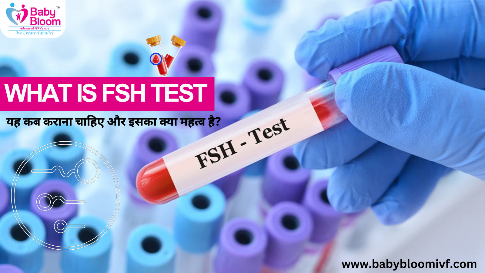 FSH Test in Hindi: यह कब कराना चाहिए और इसका क्या महत्व है?