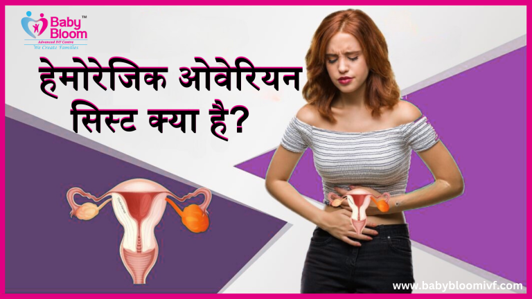 हेमोरेजिक ओवेरियन सिस्ट क्या है – महिला स्वास्थ्य संबंधी जानकारी"